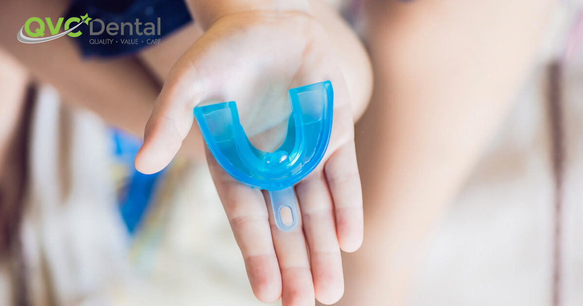 Are Custom Mouthguards Worth It?